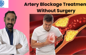 varicose veins treatment in Bengaluru