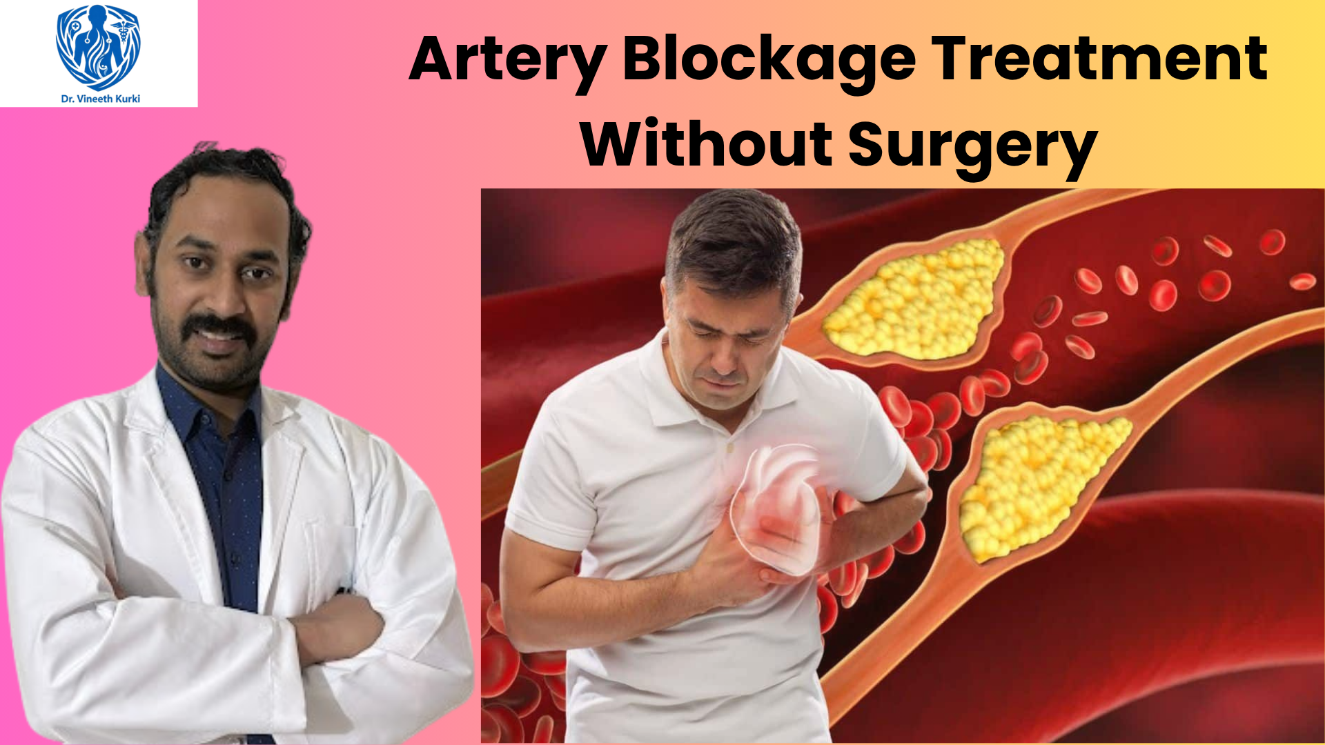 varicose veins treatment in Bengaluru