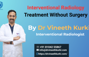 Interventional Radiology Treatment Without Surgery