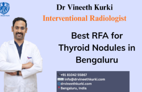 Best RFA for Thyroid Nodules in Bengaluru