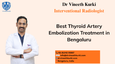 Thyroid Artery Embolization in Bengaluru
