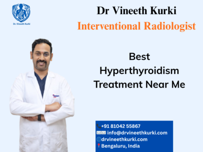 Best Hyperthyroidism Treatment in Bengaluru