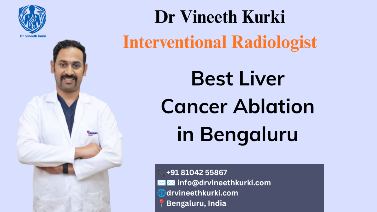 Best Liver Cancer Ablation in Bengaluru