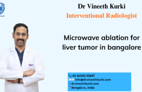 Microwave ablation for liver tumor in Bangalore