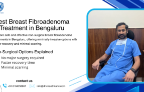 Best Breast Fibroadenoma Treatment in Bengaluru