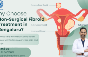 Non-Surgical Fibroid Treatment in Bengaluru