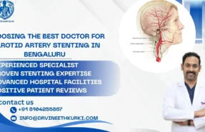 Carotid Artery Stenting