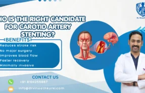 Who Is Right for Carotid Artery Stenting?