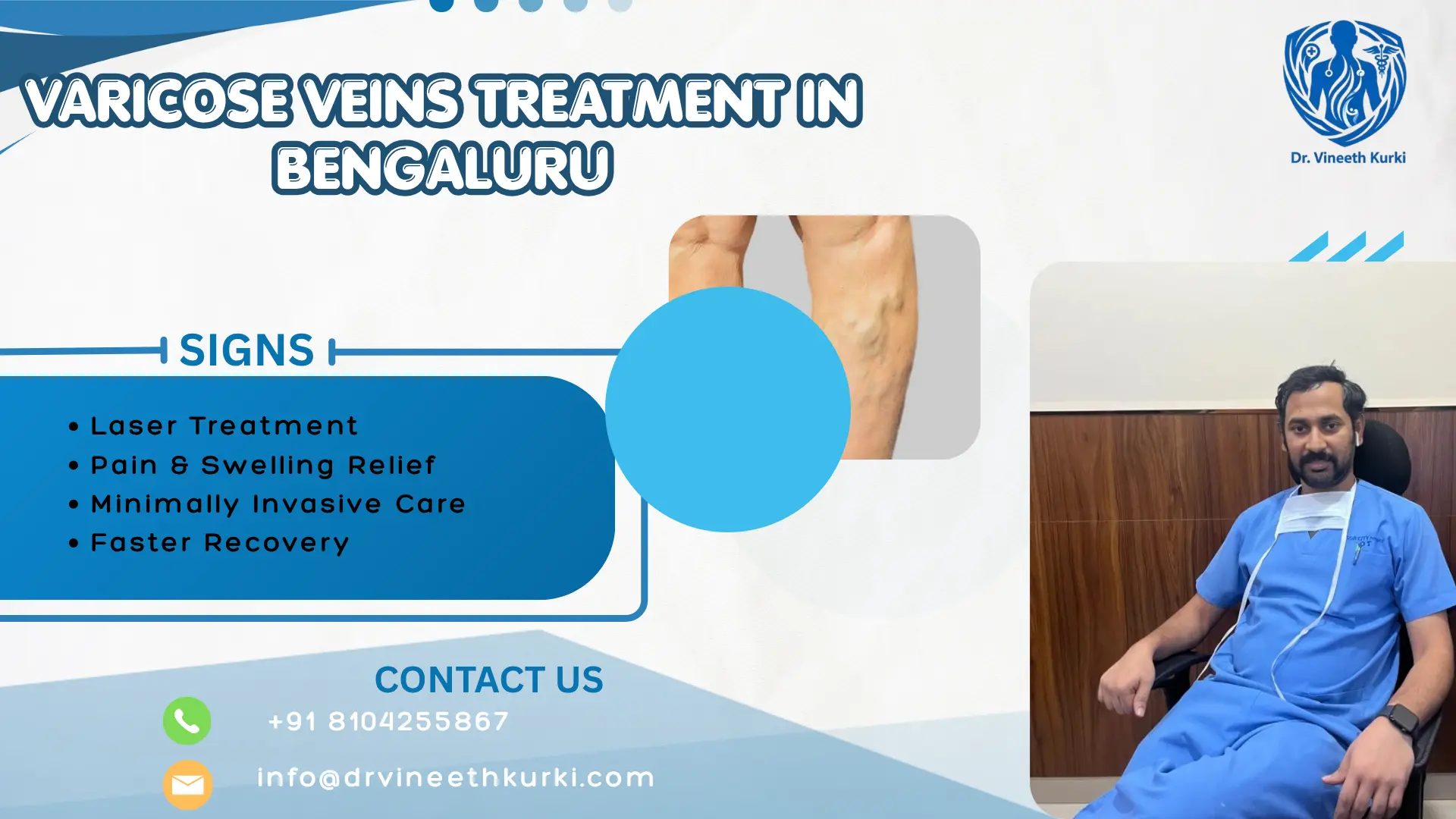 Varicose Veins Treatment in Bengaluru