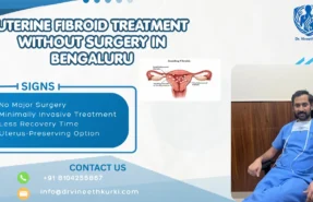 Uterine Fibroid Treatment Without Surgery in Bengaluru