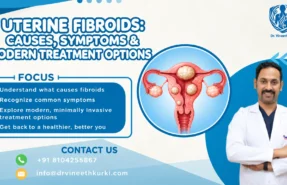 Uterine Fibroids Causes, Symptoms & Treatment