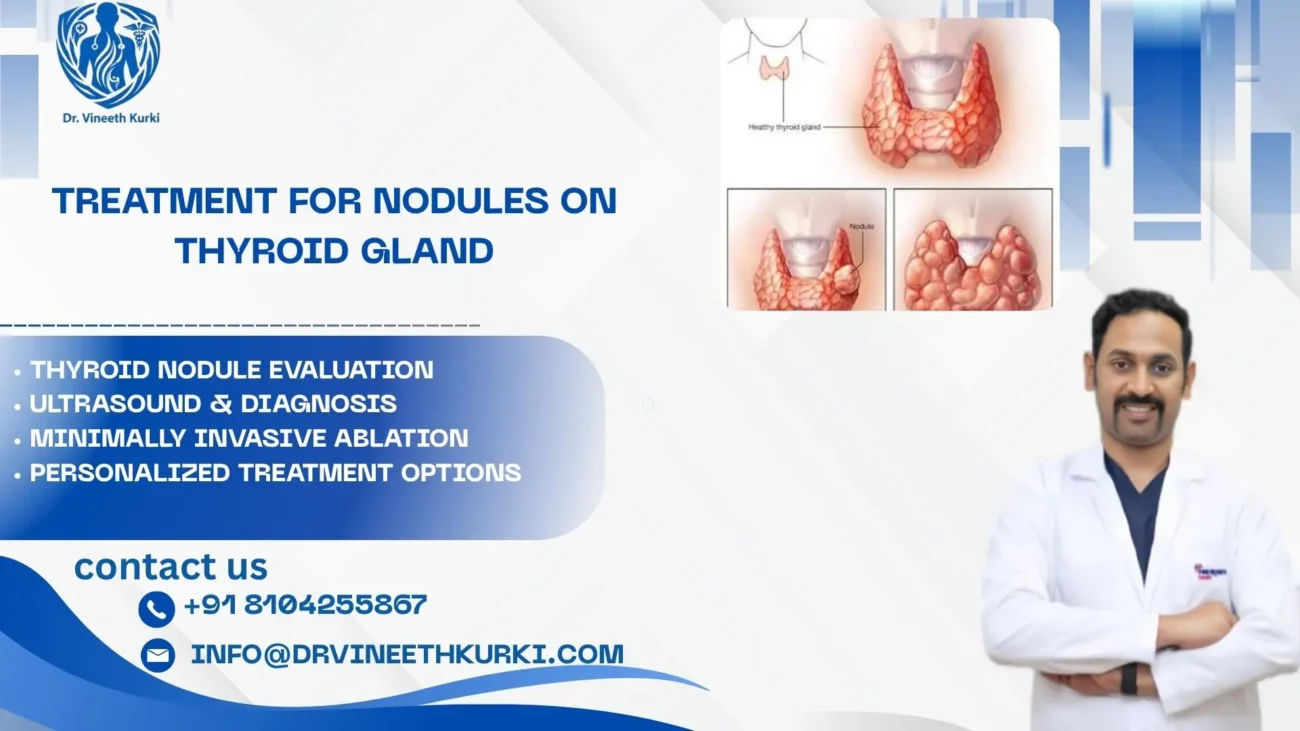 Treatment for nodules on thyroid gland