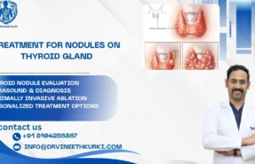 Treatment for nodules on thyroid gland