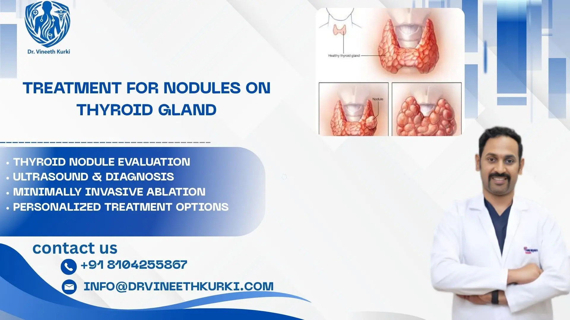 Treatment for nodules on thyroid gland