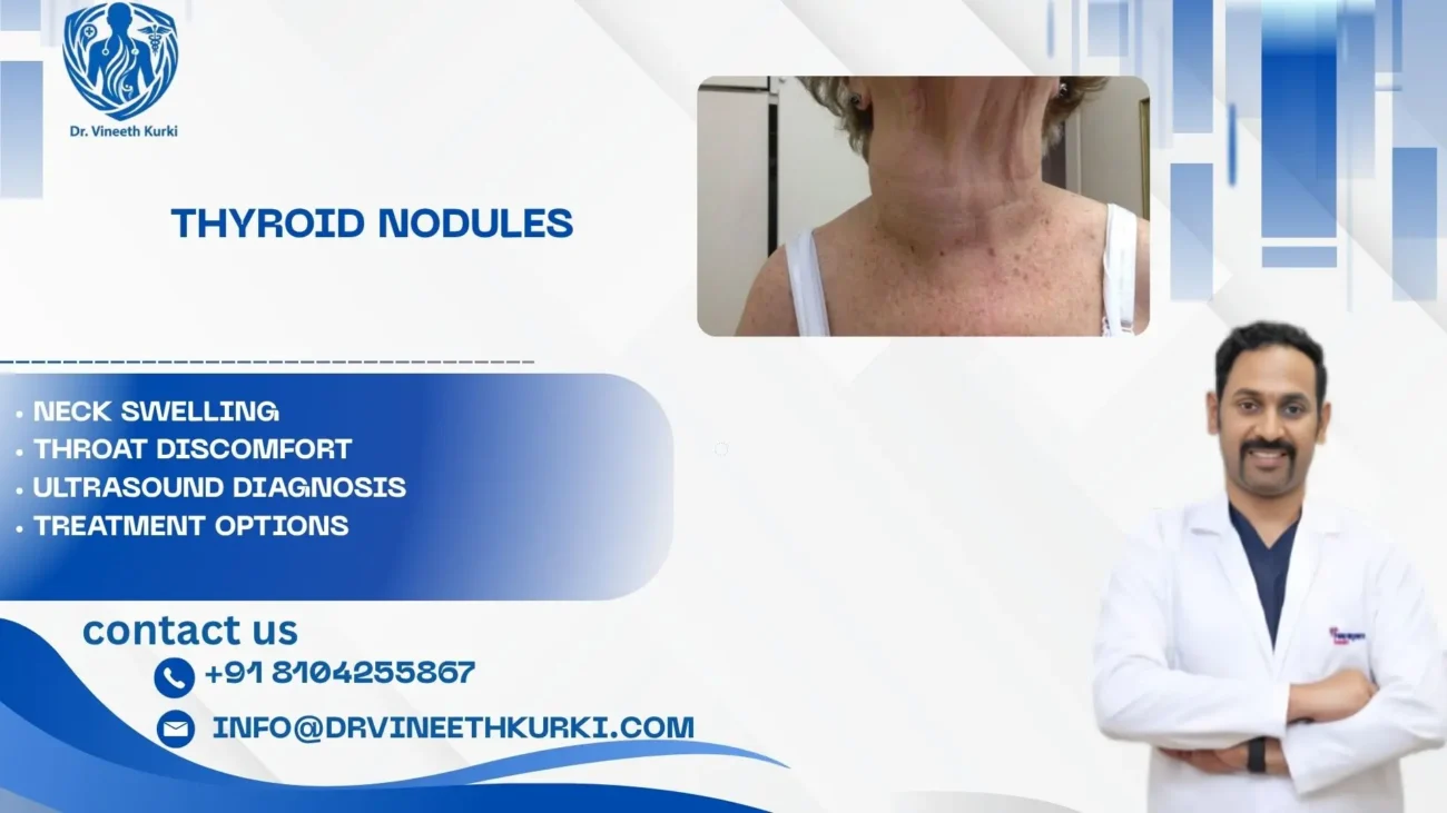 Thyroid nodules