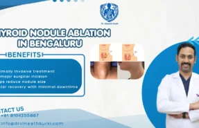 Thyroid Nodule Ablation in Bengaluru